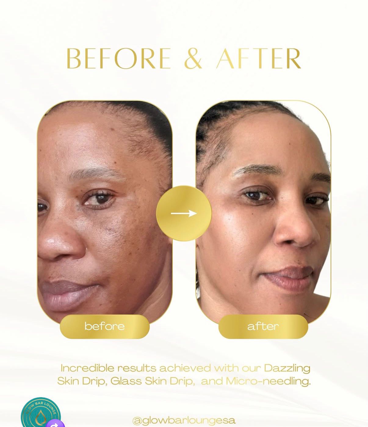 Before and after — Glow Bar Lounge results